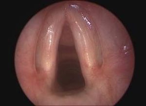 Flexible laryngoscopy for hoarseness treatment Dubai