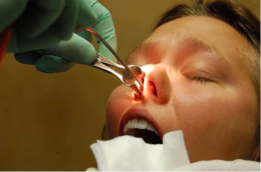 Best Septoplasty Surgeon in Dubai