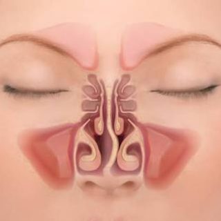 Enlarged turbinates and their impact on sleep quality