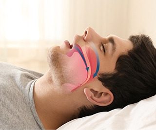 Sleep apnea causing loud snoring and breathing problems