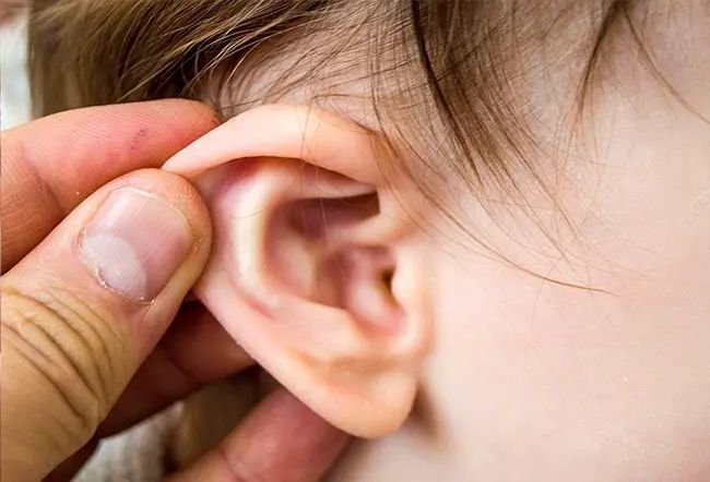 Ear infection and glue ear in children treated by pediatric ENT specialist in Dubai
