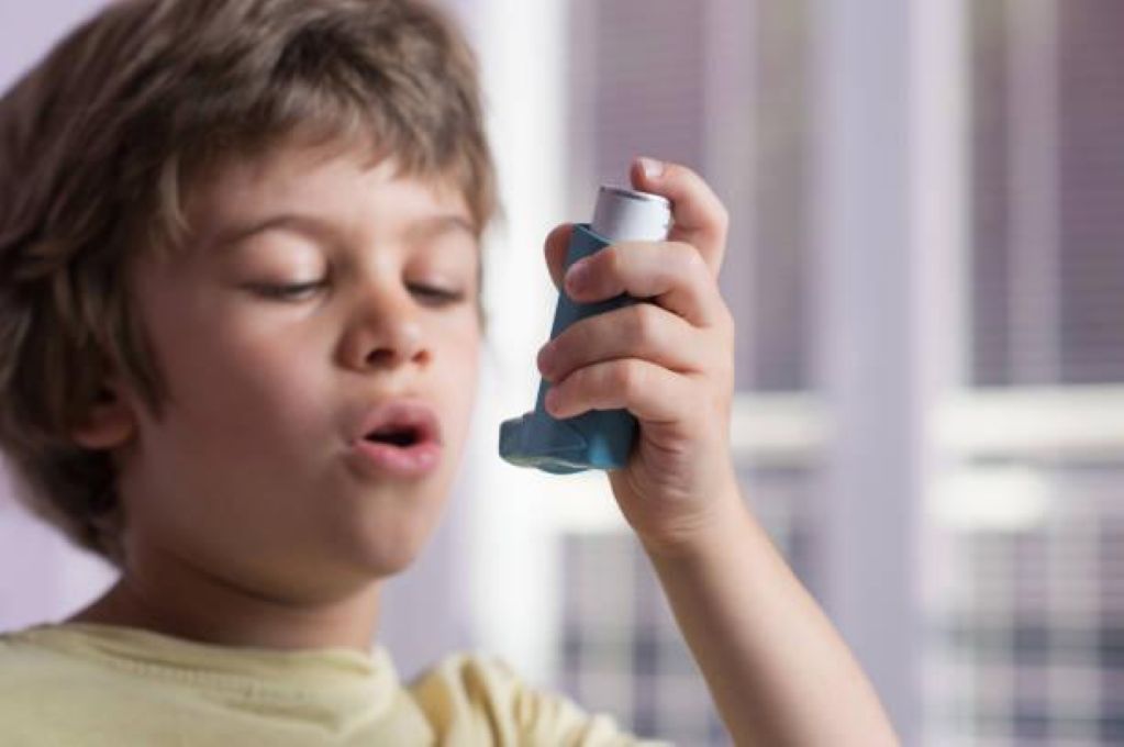 Mouth breathing treatment in children Dubai