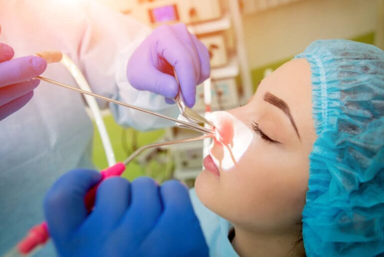 جراحة الجيوب الأنفية لعلاج لحميات الأنف