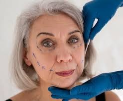 Enlarged nasal turbinates causing nasal blockage