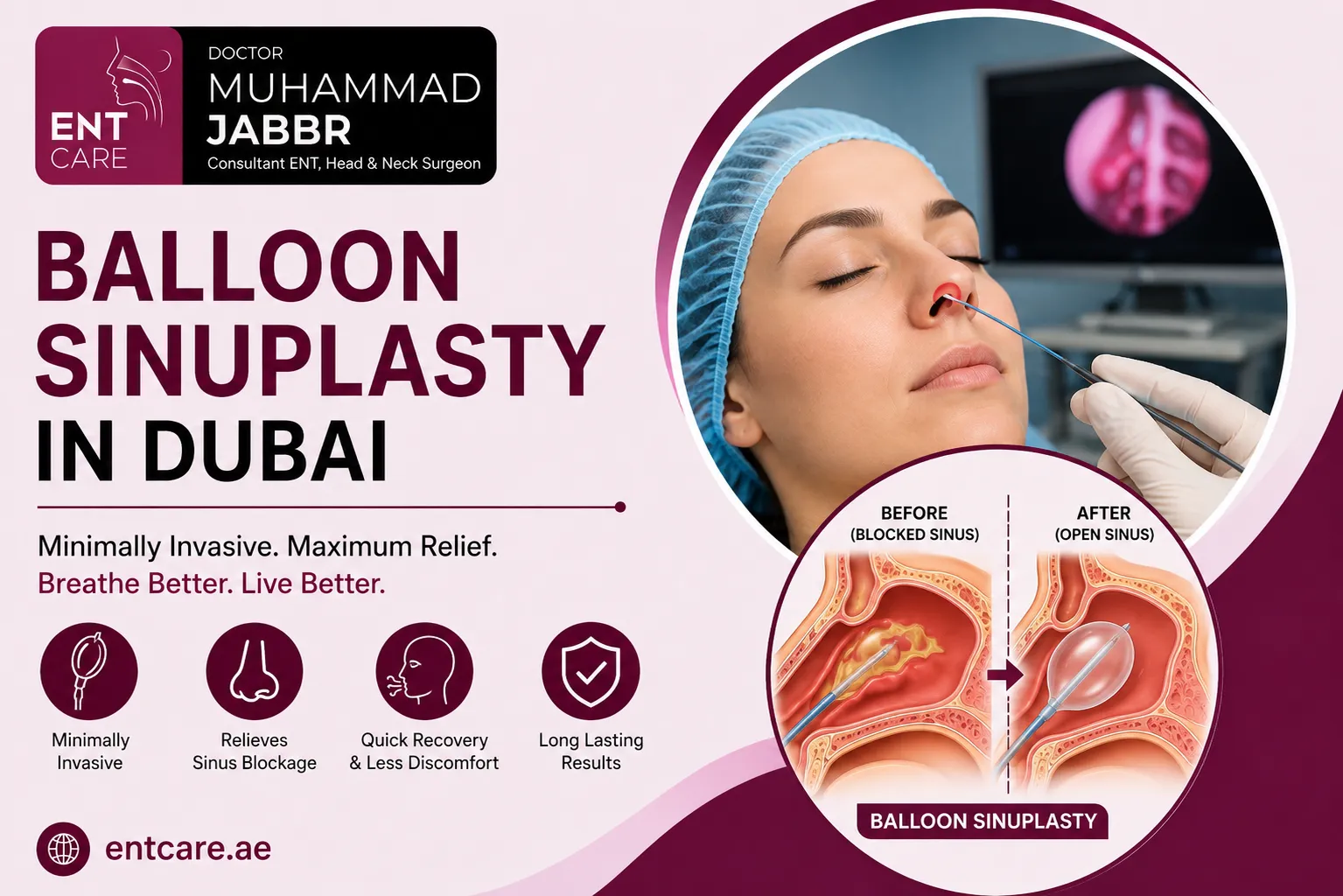 Balloon Sinuplasty in Dubai by Dr Muhammad Jabbr