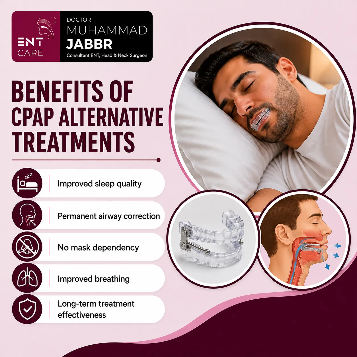 Benefits of CPAP Alternative Treatments