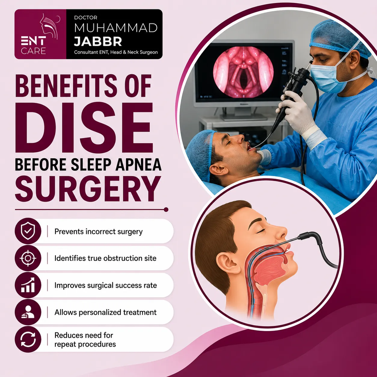 Benefits of DISE before sleep apnea surgery in Dubai
