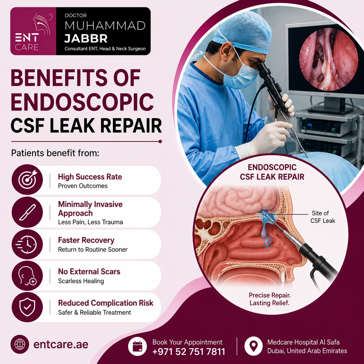 Benefits of endoscopic CSF leak repair in Dubai