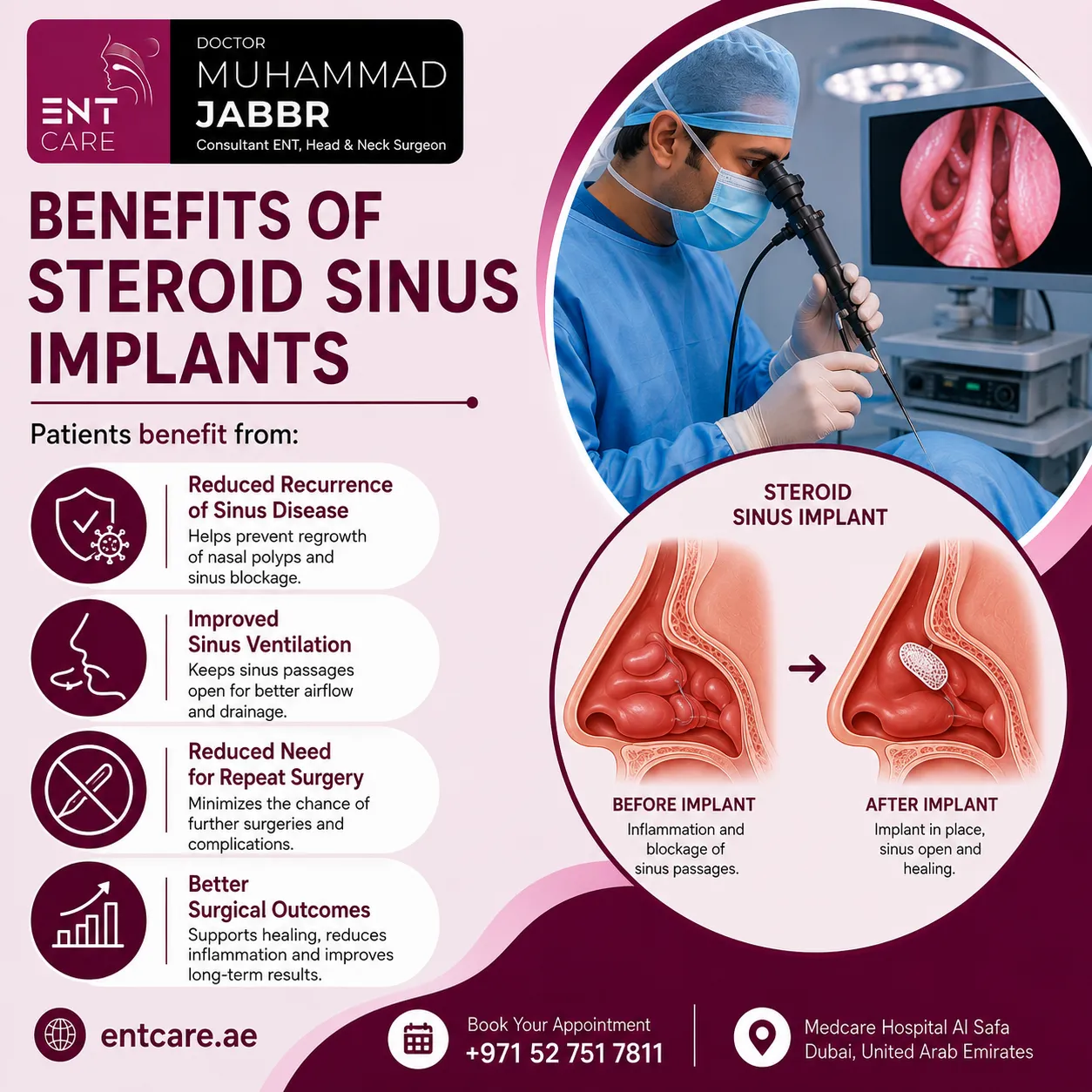 Benefits of steroid sinus implants in Dubai