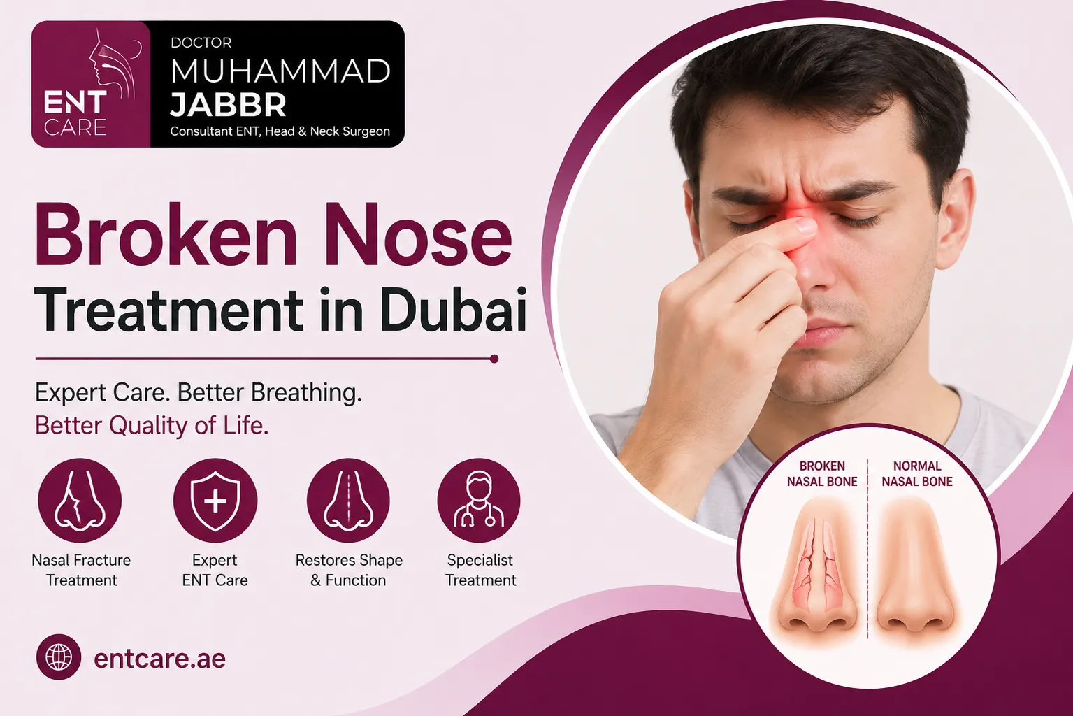 Nasal Fracture (Broken Nose) Treatment in Dubai by Dr Muhammad Jabbr