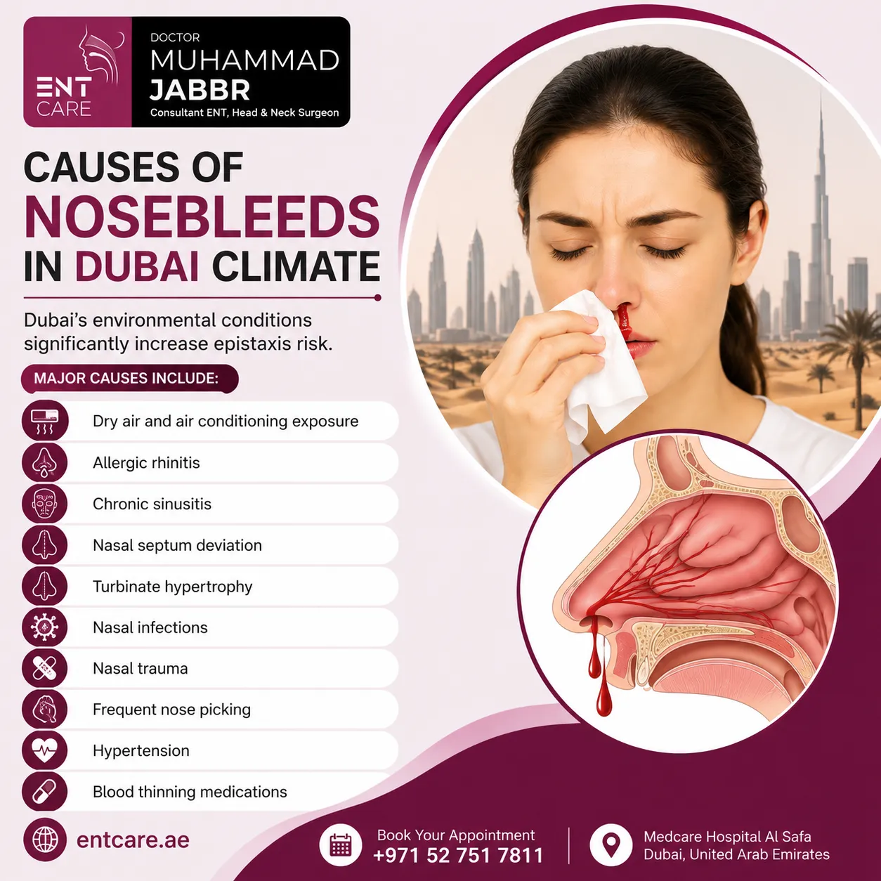 Causes of nosebleeds in Dubai
