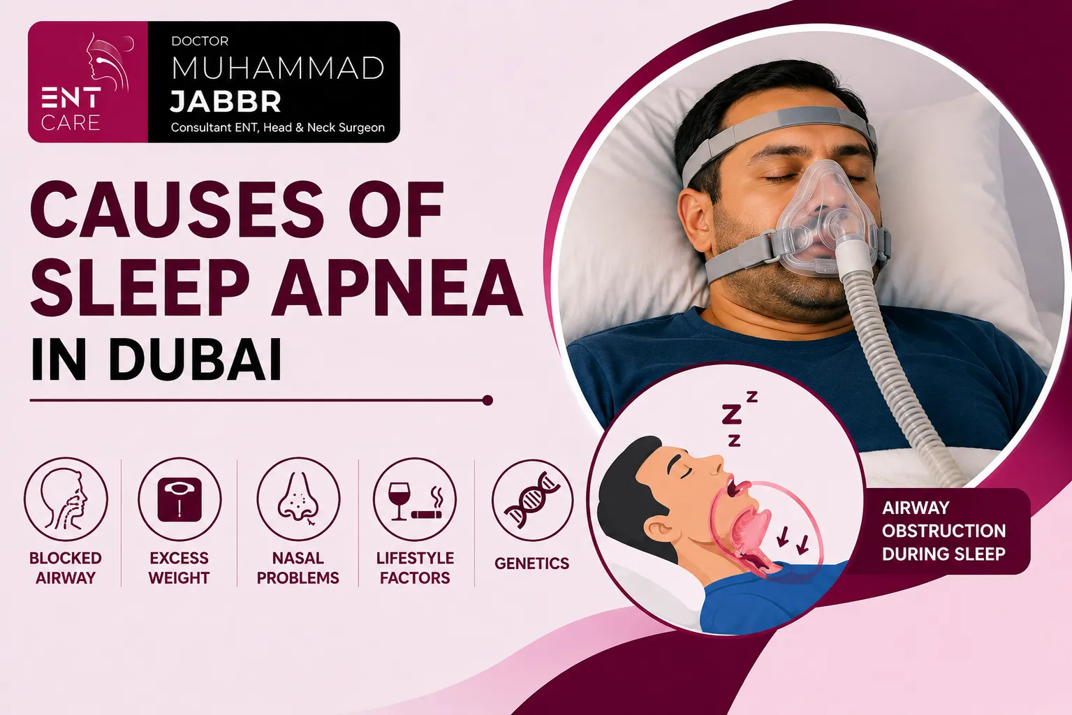 Causes of Sleep Apnea in Dubai by Dr Muhammad Jabbr