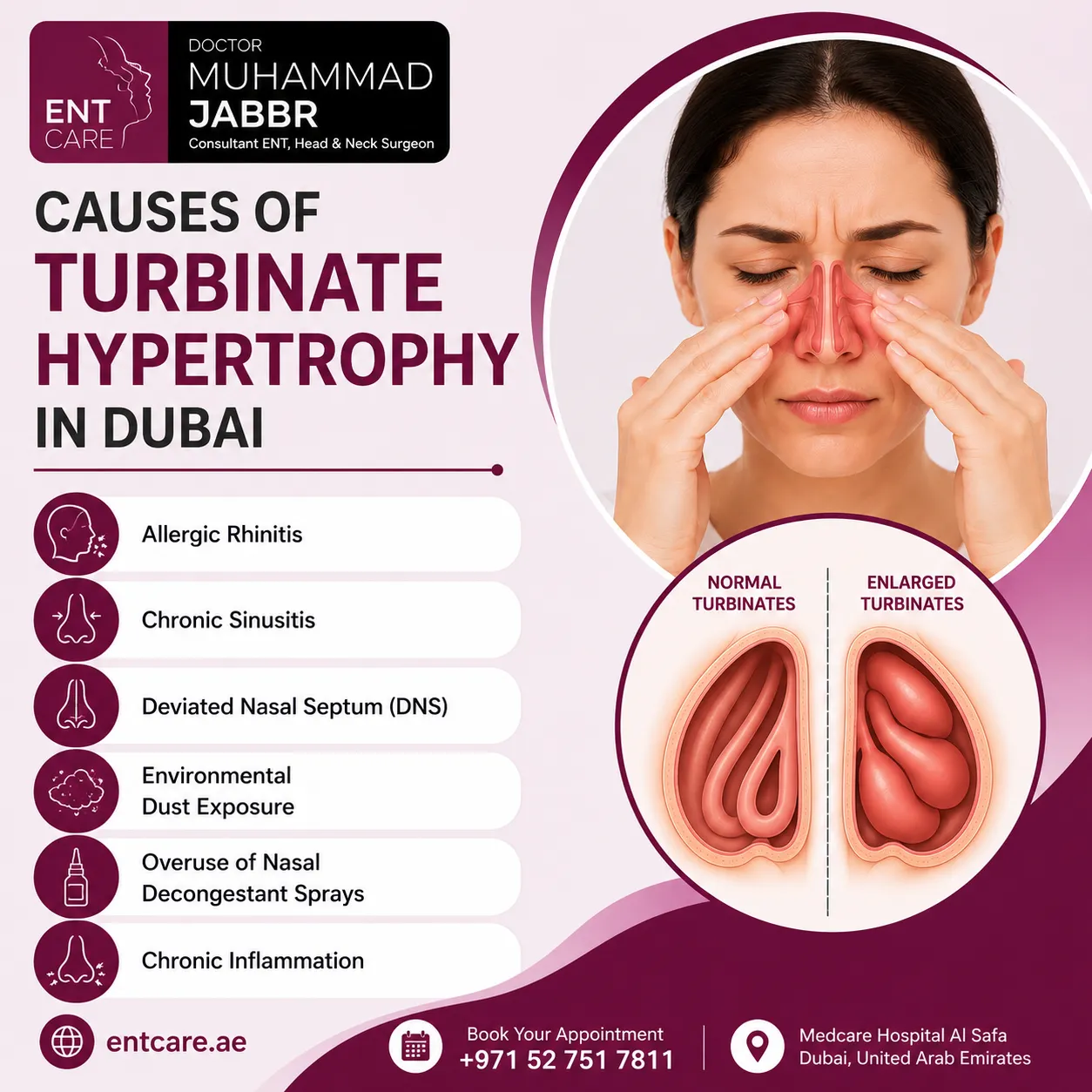 Causes of turbinate hypertrophy in Dubai