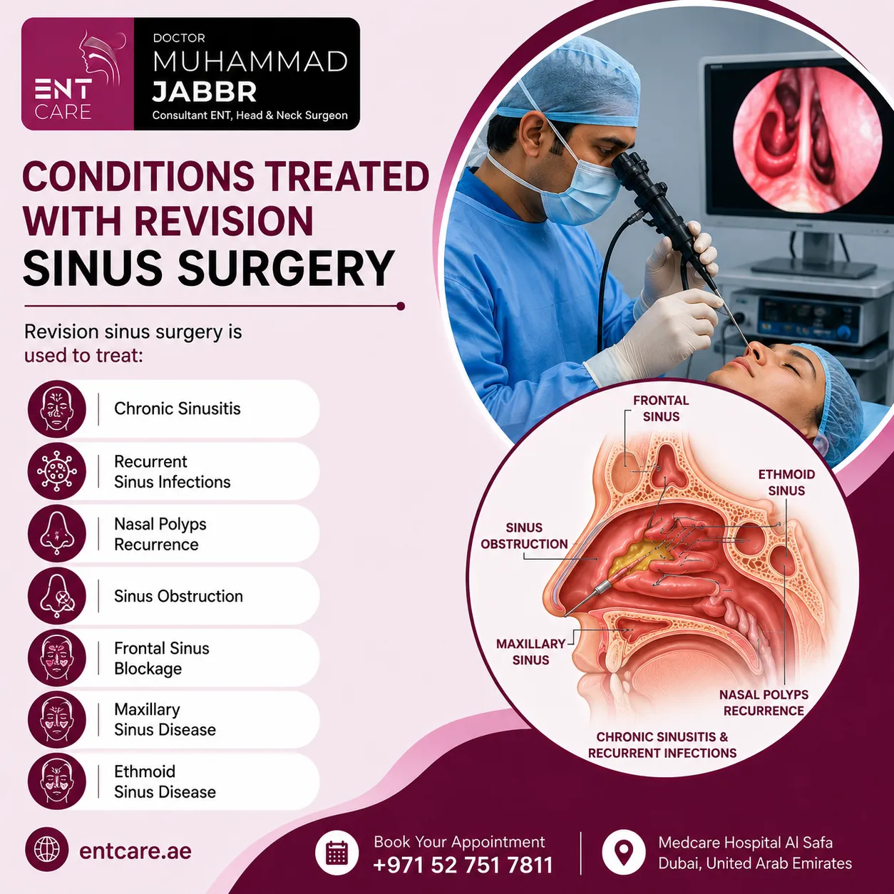 Conditions treated with revision sinus surgery in Dubai