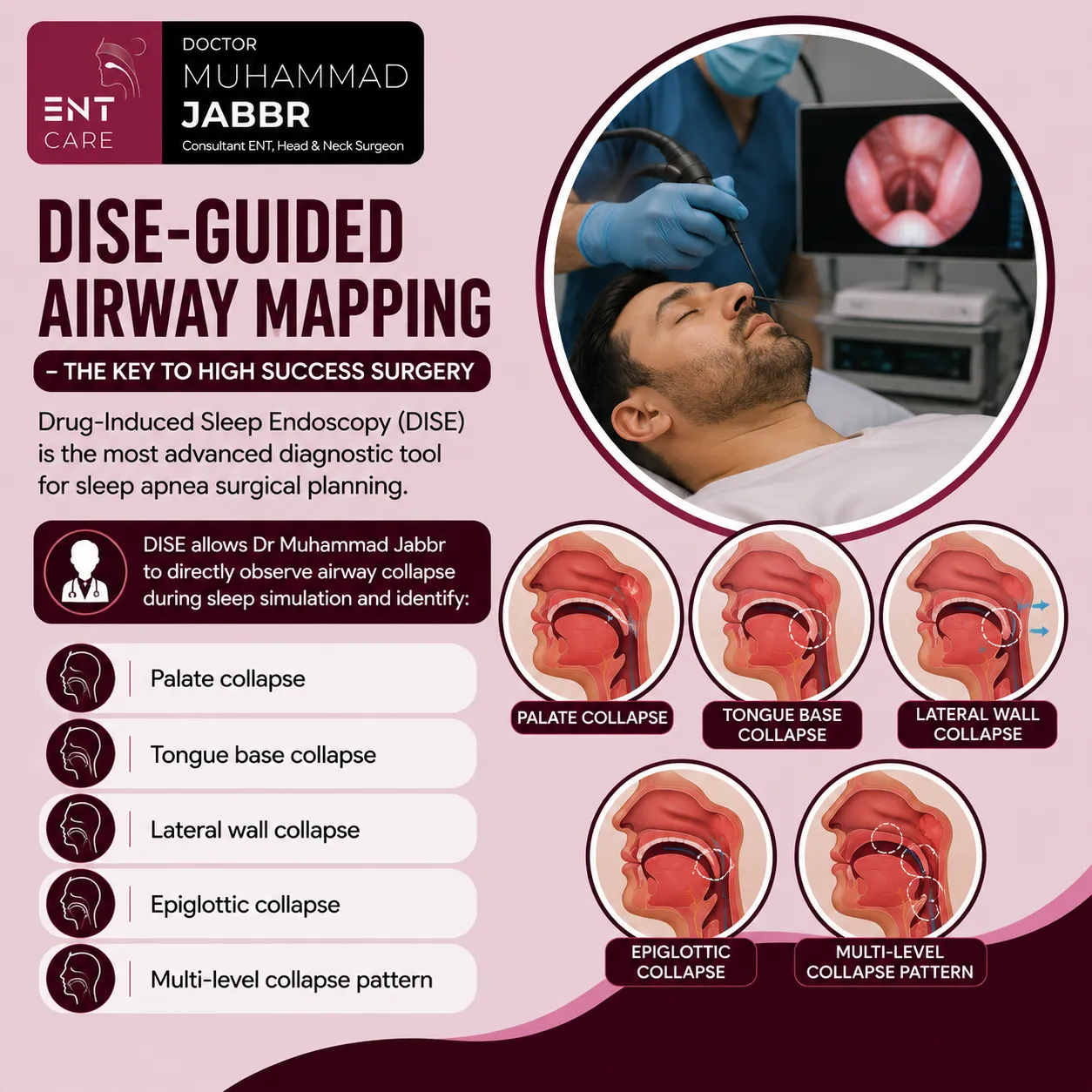 DISE-Guided Airway Mapping in Dubai