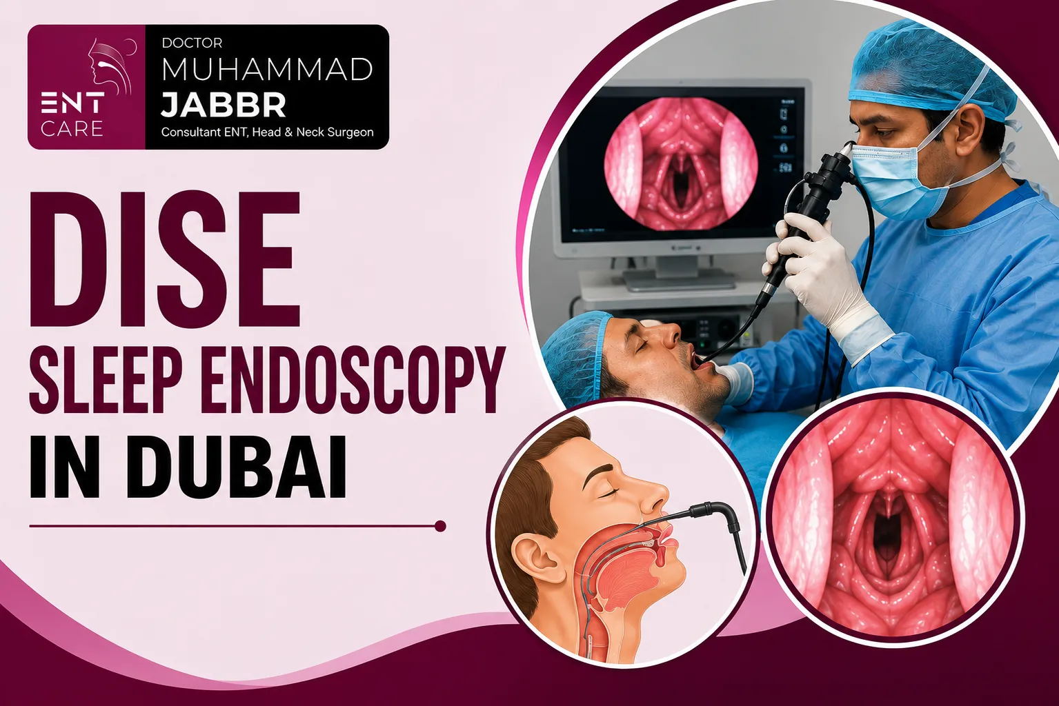DISE Sleep Endoscopy in Dubai by Dr Muhammad Jabbr