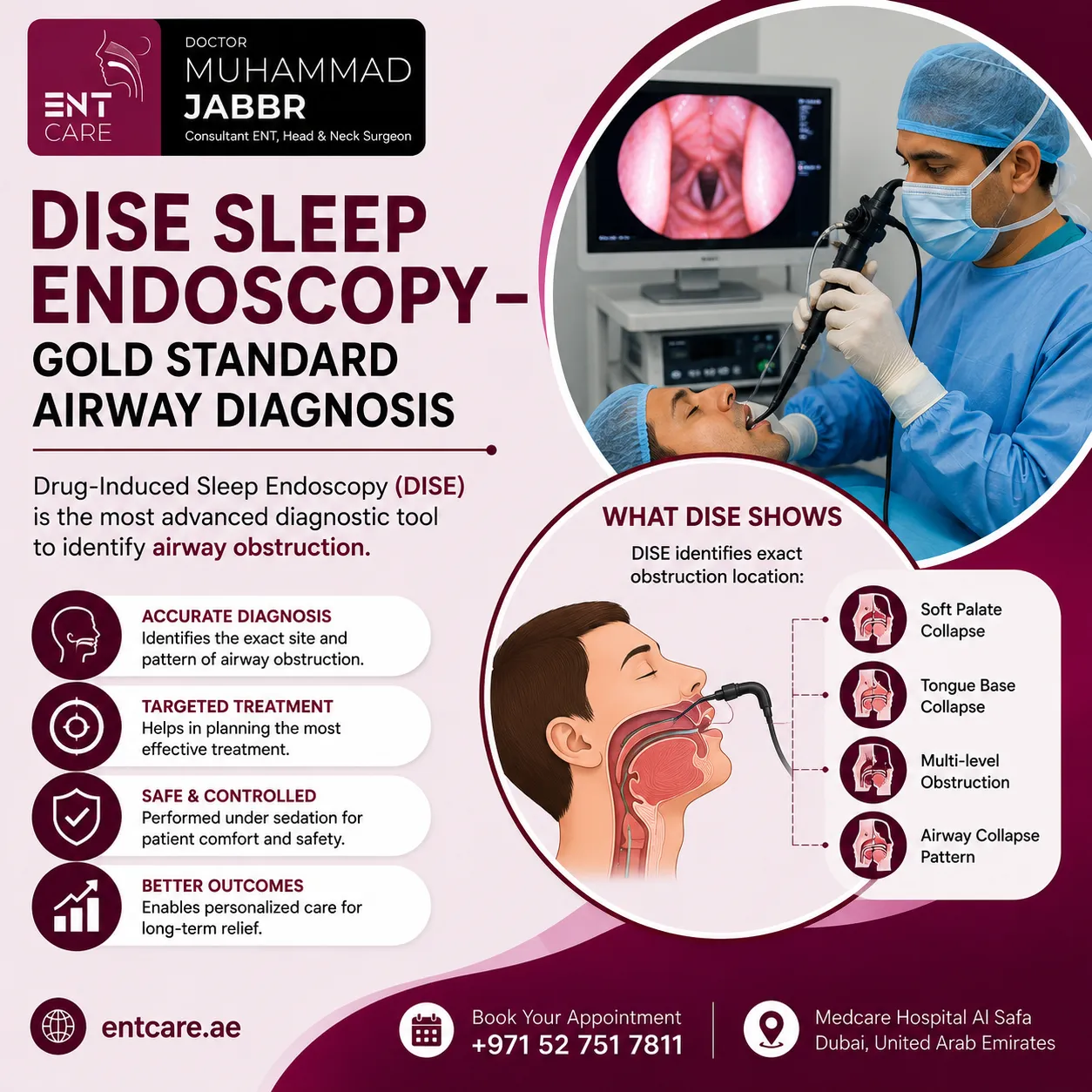 DISE sleep endoscopy diagnosis in Dubai