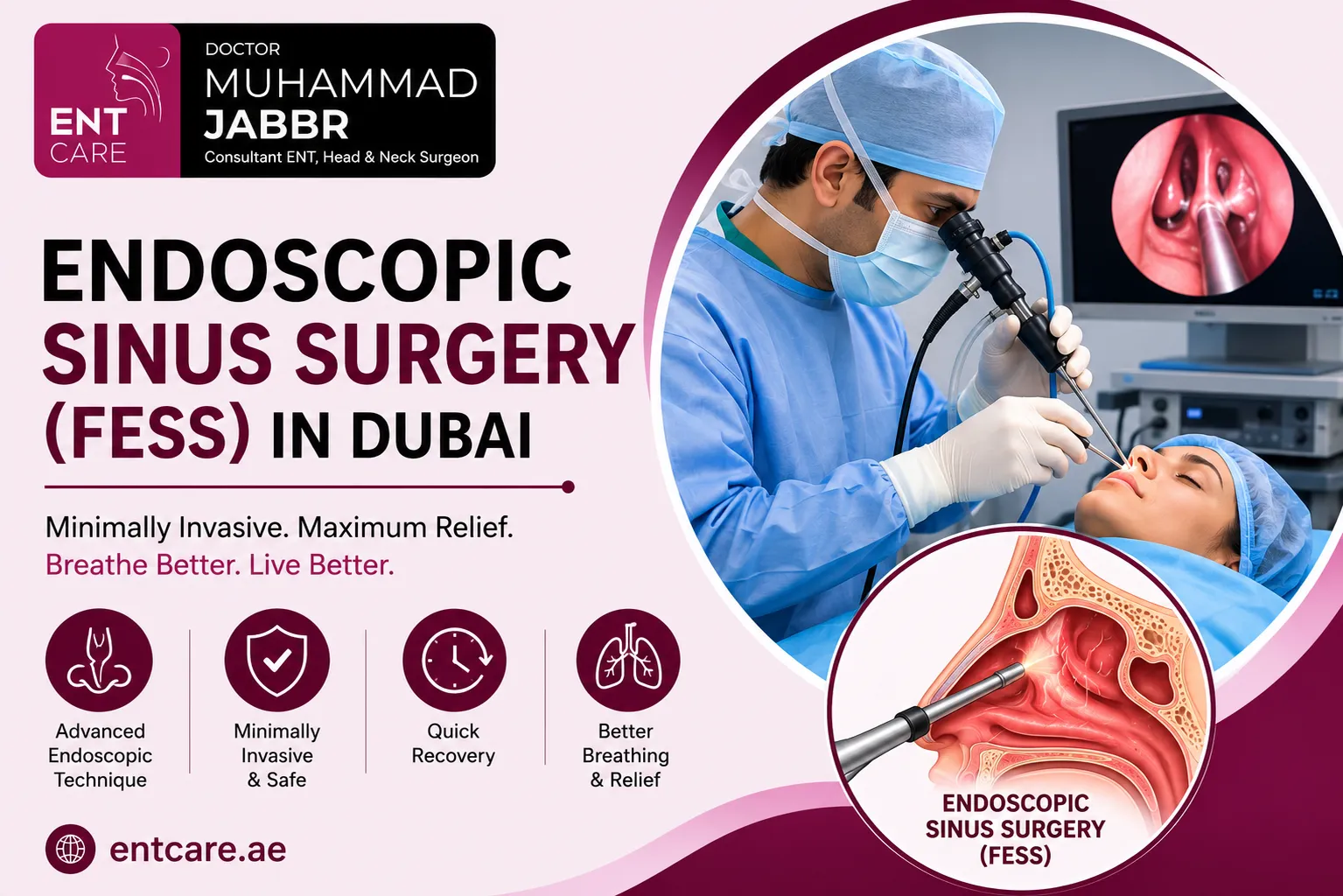 Endoscopic Sinus Surgery (FESS) in Dubai by Dr Muhammad Jabbr