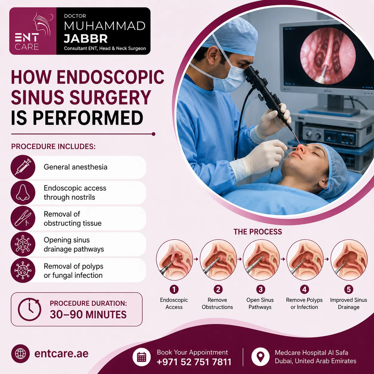 How endoscopic sinus surgery is performed in Dubai