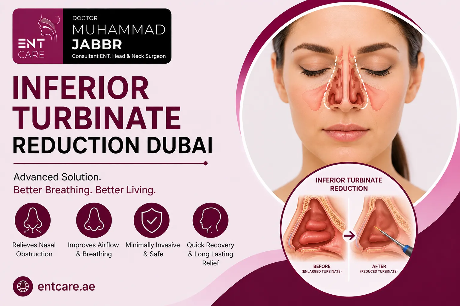 Inferior Turbinate Reduction Surgery in Dubai by Dr Muhammad Jabbr