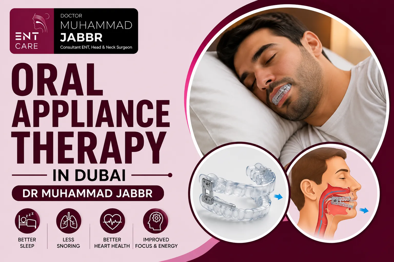 Oral Appliance Therapy in Dubai by Dr Muhammad Jabbr