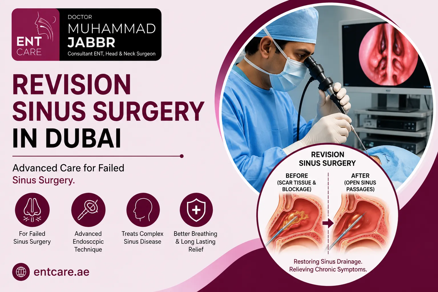Revision Sinus Surgery in Dubai by Dr Muhammad Jabbr