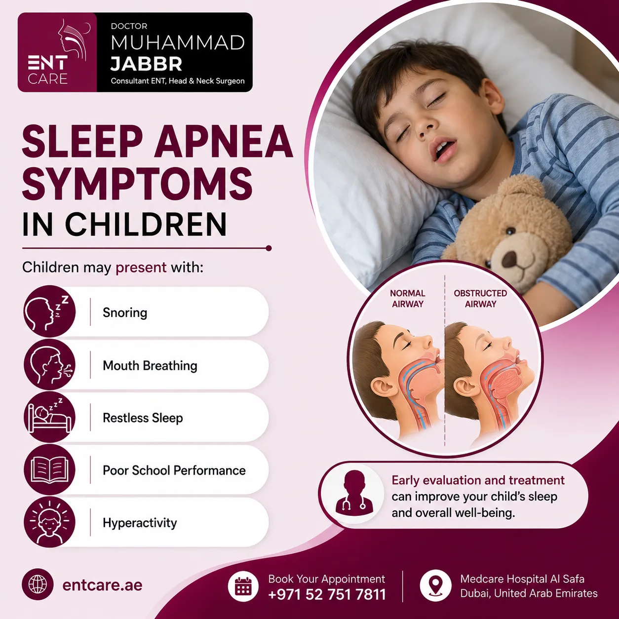 Sleep apnea symptoms in children in Dubai
