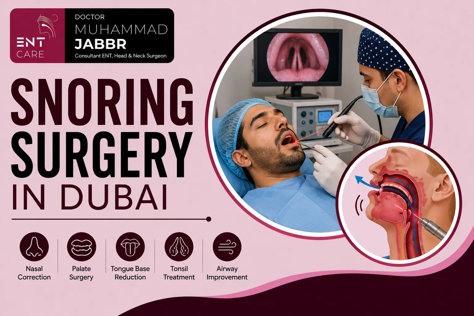 Snoring Surgery in Dubai by Dr Muhammad Jabbr
