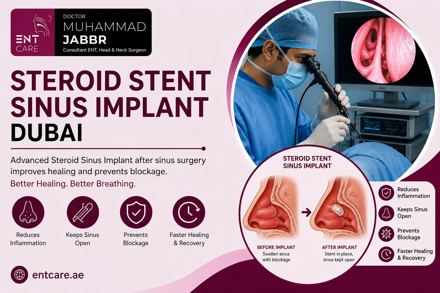 Steroid Stent Sinus Implant in Dubai by Dr Muhammad Jabbr
