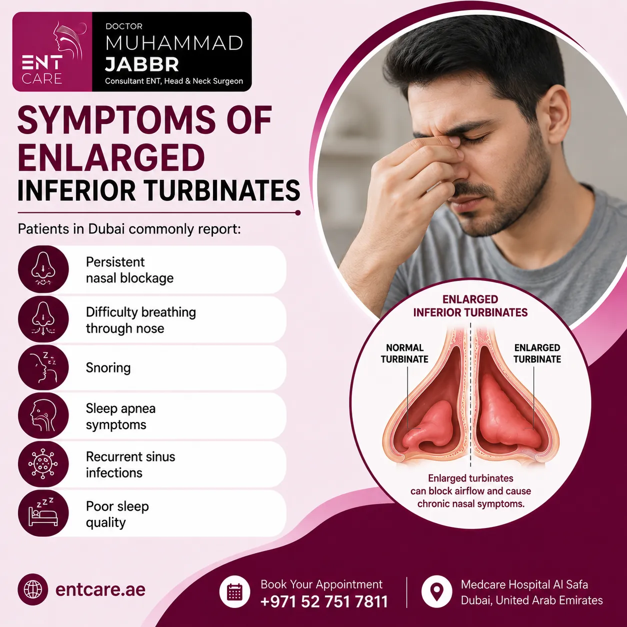 Symptoms of enlarged inferior turbinates in Dubai
