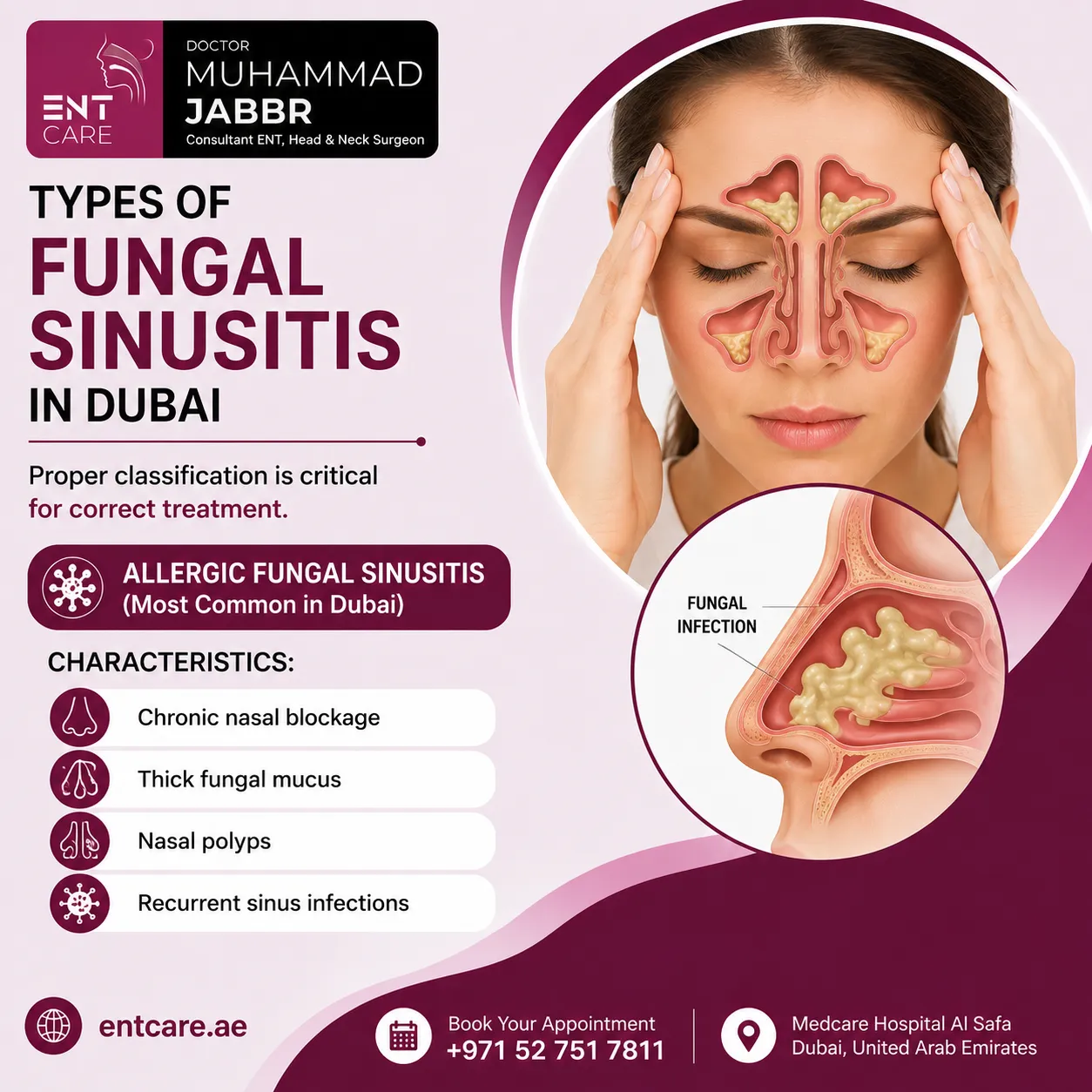 Types of fungal sinusitis in Dubai