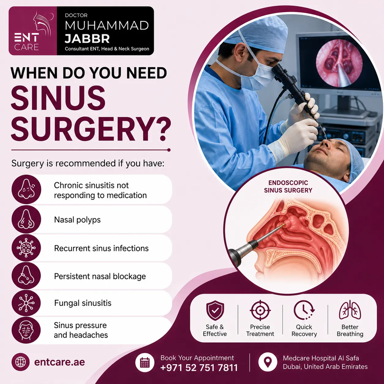 When do you need sinus surgery in Dubai