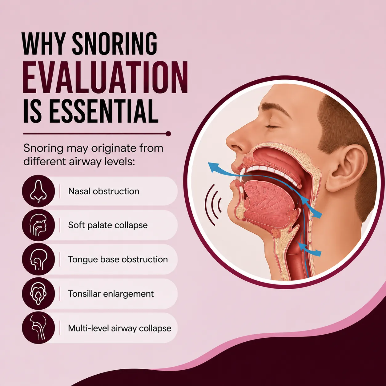 Why Snoring Evaluation is Essential
