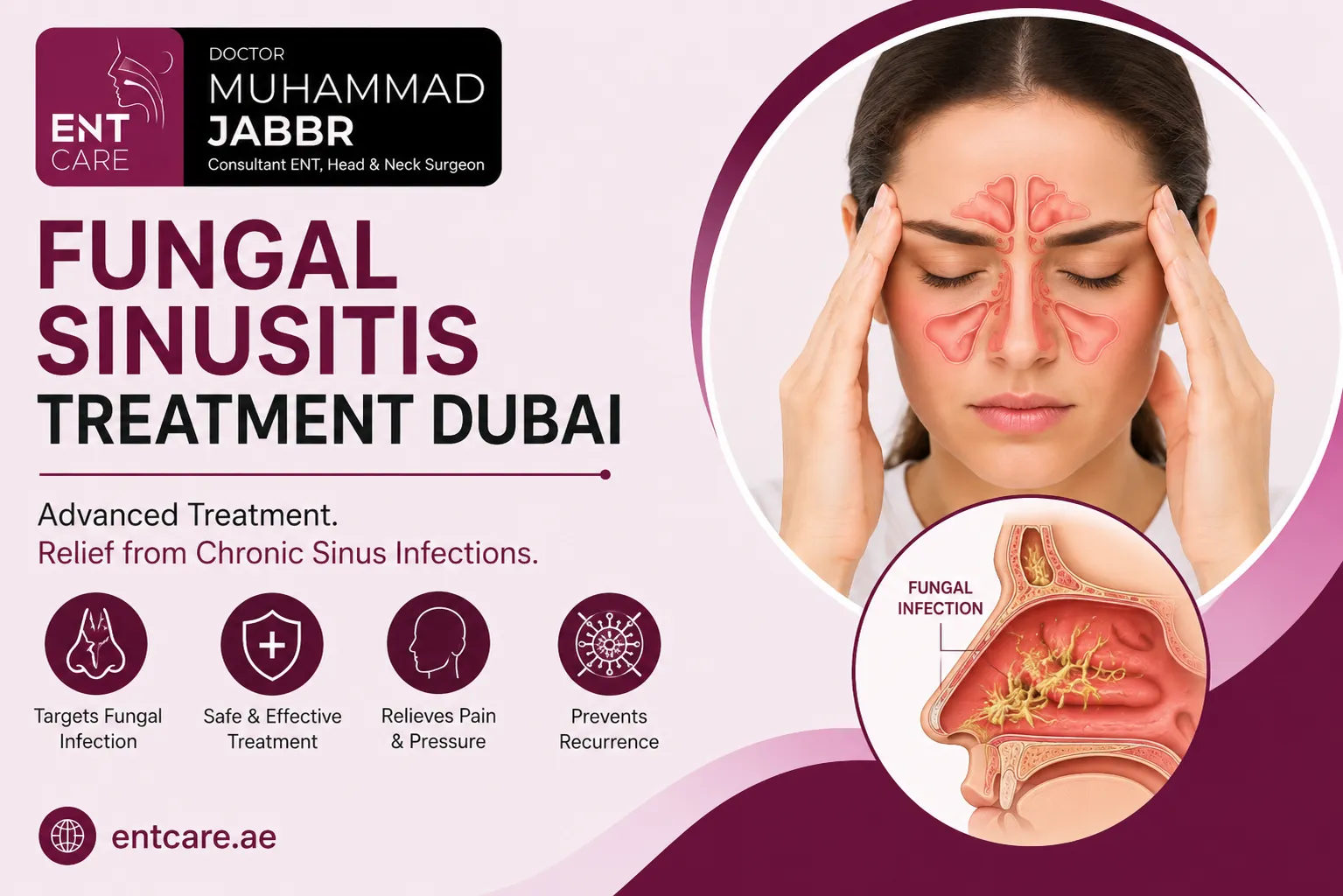 Fungal Sinusitis Treatment in Dubai by Dr Muhammad Jabbr